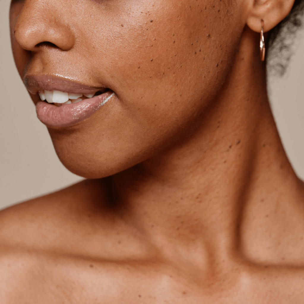 black woman with beauty spots